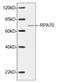 Replication protein A 70 kDa DNA-binding subunit antibody, LS-C203291, Lifespan Biosciences, Western Blot image 
