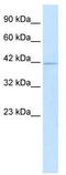 Homeobox protein Hox-A10 antibody, TA330060, Origene, Western Blot image 