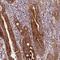 Leucine Rich Melanocyte Differentiation Associated antibody, PA5-61519, Invitrogen Antibodies, Immunohistochemistry frozen image 