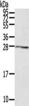 RAB20, Member RAS Oncogene Family antibody, TA350322, Origene, Western Blot image 