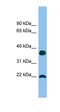 WAP four-disulfide core domain protein 1 antibody, orb330928, Biorbyt, Western Blot image 