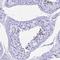 Prostate And Testis Expressed 4 antibody, NBP1-93774, Novus Biologicals, Immunohistochemistry frozen image 