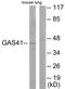 YEATS Domain Containing 4 antibody, TA314716, Origene, Western Blot image 
