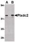 Plexin domain-containing protein 2 antibody, PA5-20467, Invitrogen Antibodies, Western Blot image 