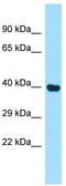 Programmed Cell Death 2 antibody, TA329160, Origene, Western Blot image 