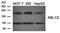 ABL Proto-Oncogene 1, Non-Receptor Tyrosine Kinase antibody, orb43410, Biorbyt, Western Blot image 