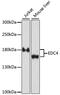 Enhancer Of MRNA Decapping 4 antibody, LS-C750385, Lifespan Biosciences, Western Blot image 