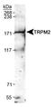 Transient Receptor Potential Cation Channel Subfamily M Member 2 antibody, TA336554, Origene, Western Blot image 