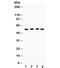 Fascin Actin-Bundling Protein 1 antibody, R32251, NSJ Bioreagents, Western Blot image 