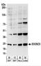 Exosome complex exonuclease RRP46 antibody, NBP2-22241, Novus Biologicals, Western Blot image 