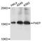 Progestagen Associated Endometrial Protein antibody, A11810, ABclonal Technology, Western Blot image 