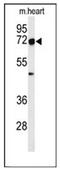 Protein artemis antibody, AP51199PU-N, Origene, Western Blot image 