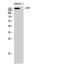 Rho Guanine Nucleotide Exchange Factor 12 antibody, STJ93900, St John