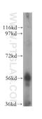 Cytochrome P450 Family 2 Subfamily C Member 8 antibody, 16546-1-AP, Proteintech Group, Western Blot image 