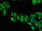 Receptor Interacting Serine/Threonine Kinase 1 antibody, LS-C679278, Lifespan Biosciences, Immunofluorescence image 