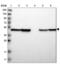 Abhydrolase Domain Containing 3 antibody, NBP1-81327, Novus Biologicals, Western Blot image 