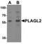 Zinc finger protein PLAGL2 antibody, TA319695, Origene, Western Blot image 