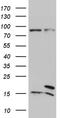 SEC11 Homolog A, Signal Peptidase Complex Subunit antibody, LS-C795920, Lifespan Biosciences, Western Blot image 