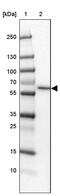 Solute Carrier Family 13 Member 1 antibody, PA5-62818, Invitrogen Antibodies, Western Blot image 