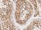 Cell Division Cycle 14A antibody, 209175-T08, Sino Biological, Immunohistochemistry frozen image 