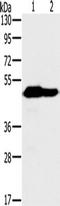 NADH:Ubiquinone Oxidoreductase Core Subunit V1 antibody, TA350221, Origene, Western Blot image 