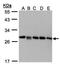 GDP Dissociation Inhibitor 2 antibody, orb89508, Biorbyt, Western Blot image 