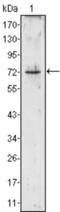 PR-3 antibody, abx011403, Abbexa, Enzyme Linked Immunosorbent Assay image 