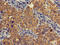 Acyloxyacyl Hydrolase antibody, CSB-PA001853LA01HU, Cusabio, Immunohistochemistry paraffin image 