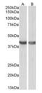 Protein HEXIM1 antibody, orb19364, Biorbyt, Western Blot image 
