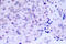 RB Transcriptional Corepressor 1 antibody, LS-C176196, Lifespan Biosciences, Immunohistochemistry paraffin image 