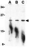 Peptidyl-tRNA hydrolase 2, mitochondrial antibody, GTX85498, GeneTex, Western Blot image 