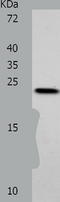 Visinin Like 1 antibody, TA322856, Origene, Western Blot image 