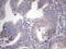PLAU antibody, M04352-1, Boster Biological Technology, Immunohistochemistry paraffin image 