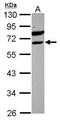 ETV6 antibody, GTX105673, GeneTex, Western Blot image 