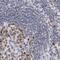 Nuclear Autoantigenic Sperm Protein antibody, PA5-55776, Invitrogen Antibodies, Immunohistochemistry frozen image 