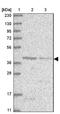 Malonyl-CoA-acyl carrier protein transacylase, mitochondrial antibody, NBP1-83936, Novus Biologicals, Western Blot image 