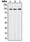 Protein SMG7 antibody, LS-C353204, Lifespan Biosciences, Western Blot image 