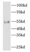 FKBP Prolyl Isomerase 8 antibody, FNab03149, FineTest, Western Blot image 