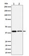 Stomatin-like protein 2 antibody, M04108-1, Boster Biological Technology, Western Blot image 