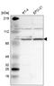 X-linked retinitis pigmentosa GTPase regulator antibody, HPA001593, Atlas Antibodies, Western Blot image 