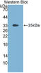 Fibrinogen Gamma Chain antibody, LS-C374511, Lifespan Biosciences, Western Blot image 