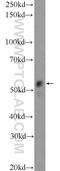 Katanin Catalytic Subunit A1 Like 1 antibody, 20166-1-AP, Proteintech Group, Western Blot image 