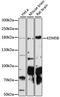 Lysine Demethylase 5B antibody, LS-C749116, Lifespan Biosciences, Western Blot image 
