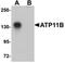 Probable phospholipid-transporting ATPase IF antibody, orb75464, Biorbyt, Western Blot image 