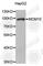 Minichromosome Maintenance 10 Replication Initiation Factor antibody, A5427, ABclonal Technology, Western Blot image 