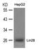 Lin-28 Homolog A antibody, 79-647, ProSci, Western Blot image 