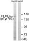 Phospholipase C Gamma 2 antibody, PA5-38244, Invitrogen Antibodies, Western Blot image 
