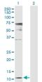 Zinc Ribbon Domain Containing 1 antibody, H00030834-D01P, Novus Biologicals, Western Blot image 