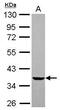 Lysophosphatidic Acid Receptor 1 antibody, GTX112916, GeneTex, Western Blot image 