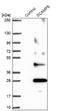 Secretory carrier-associated membrane protein 5 antibody, NBP2-13284, Novus Biologicals, Western Blot image 